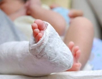 Kid on ventilator