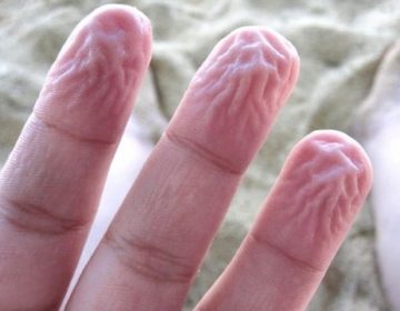 Fingers