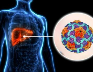 What is Hepatitis