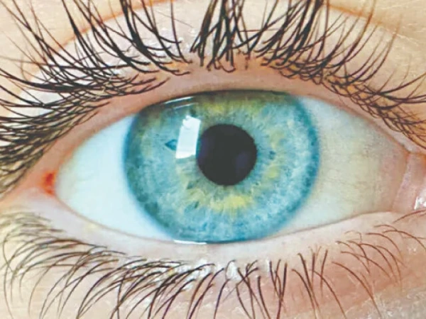 Eyes Color