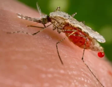 Malaria