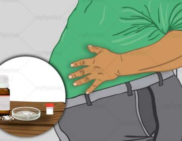 Obesity