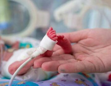 Premature Birth
