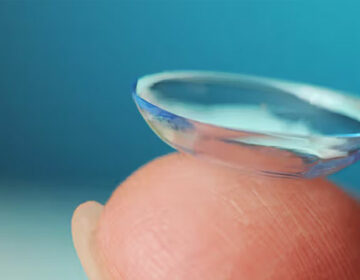 Contact Lens
